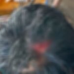 PH-Navy-Officer-Injured-in-Confrontation-with-China-Coast-Guard-at-Ayungin-Shoal.jpg