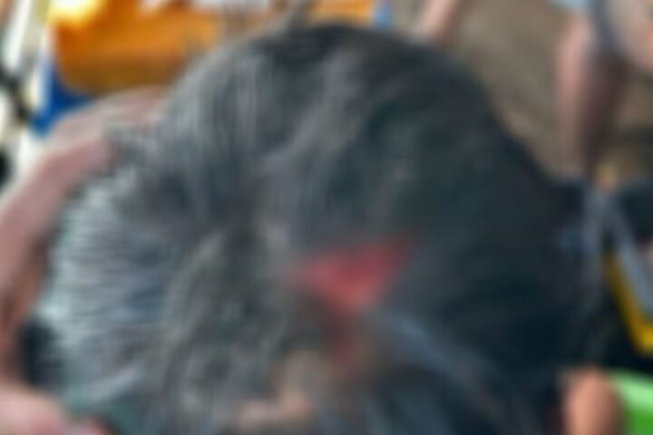 PH-Navy-Officer-Injured-in-Confrontation-with-China-Coast-Guard-at-Ayungin-Shoal.jpg